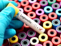 RISCO DE CONTÁGIO DE LEGIONELLA EM TRABALHO: MEDIDAS DE PREVENÇÃO