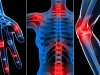 LESÕES MUSCULO ESQUELÉTICAS E DOENÇA PROFISSIONAL