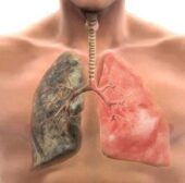 A PROBLEMÁTICA DE QUEIXAS RESPIRATÓRIAS